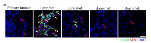 转入幼鼠模型得到一样的试验了局，且在转移产生前NET已在肝脏聚积。