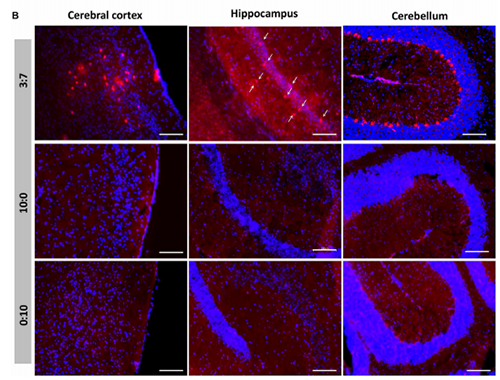 被包裹在含有NT-类脂质的LNP中的Cre沉组酶成功转移。大脑中的转染神经元呈红色高亮。