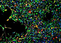 世界初创：药物将干细胞疏导至受损部位，提高其愈合能力！