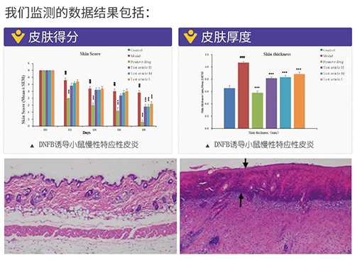 J9集团成立的特应性皮炎及湿疹模型监测数据了局