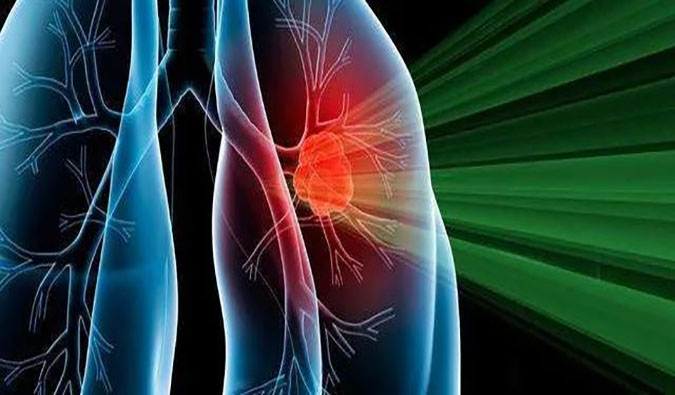 盛世泰科1类创新药物CGT-9475实现中美双报双批 | J9集团一站式临床前生物医药研发服务平台助力