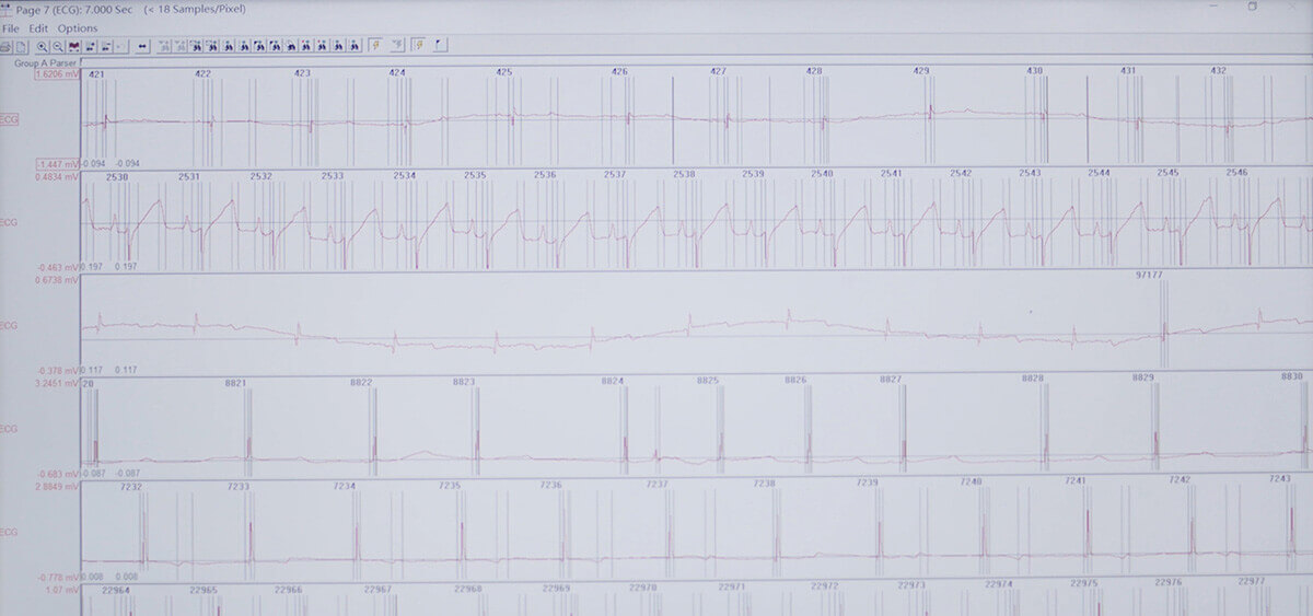 J9集团 SEND 数据转换平台