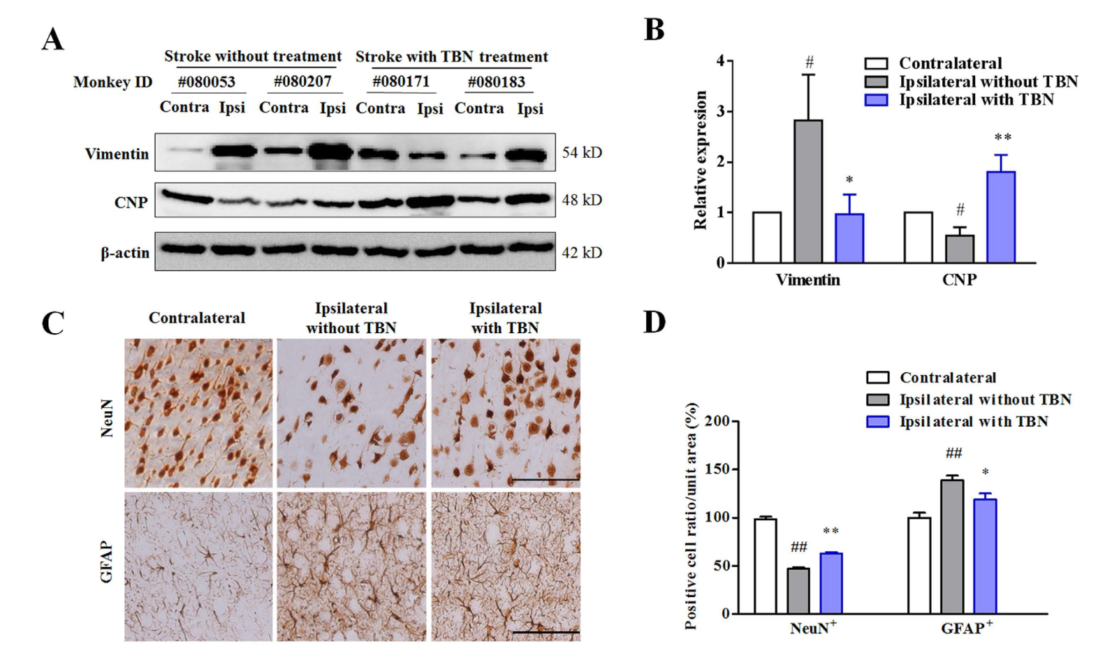 TBN是一种医治缺血性卒中的新型临床候选药物，本钻研中TBN通过J9集团合成